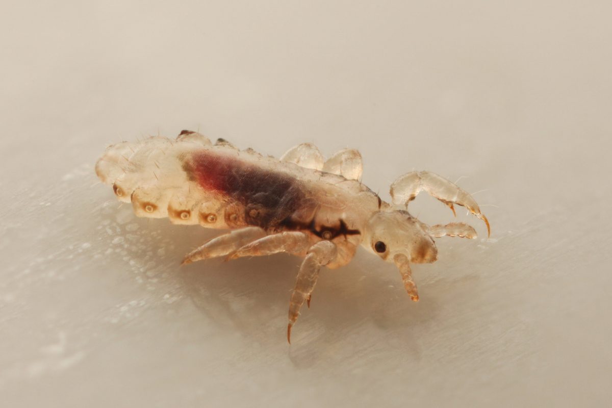 HEAD LICE (LOUSE) PICTURES Lice Treatment Let's Be PALS Va Bch