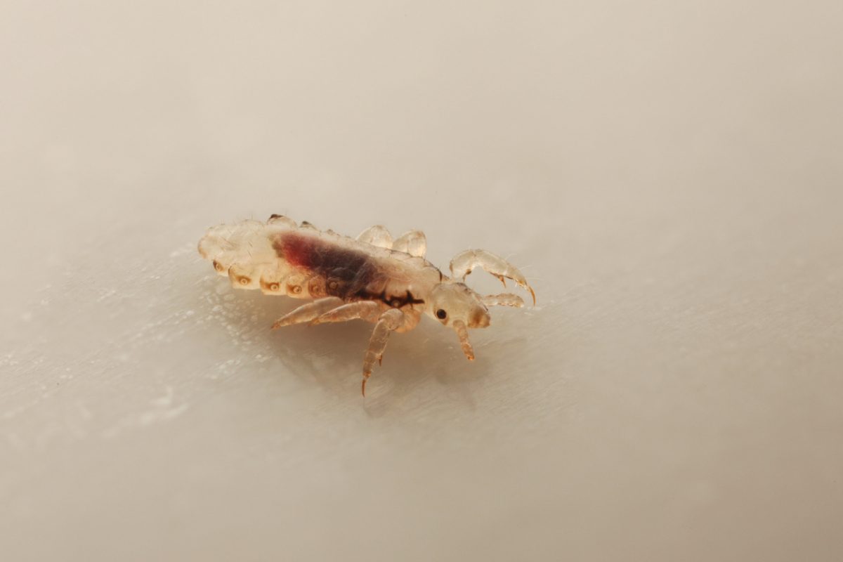 HEAD LICE (LOUSE) PICTURES Lice Treatment Let's Be PALS Va Bch